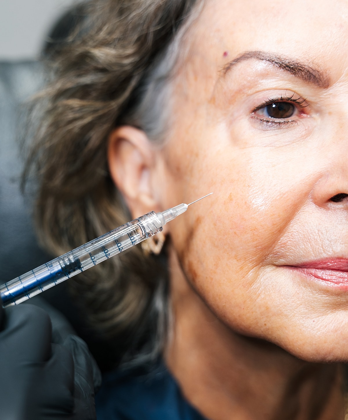 Woman receiving facial injection or aesthetic treatment.
