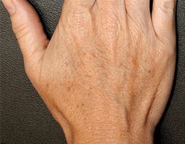 Human hand on dark background.