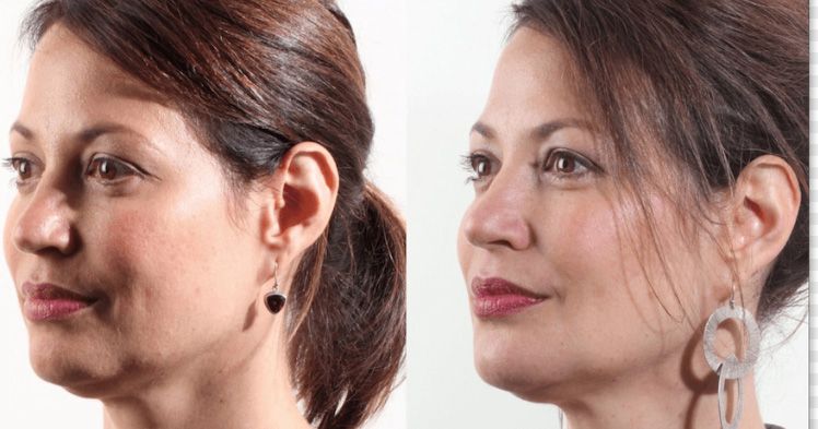 Profile comparison of two women with earrings.
