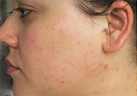 Woman with natural facial features and light makeup.