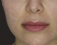 Close-up of lips and chin area.