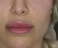 Close-up of lips with subtle makeup.