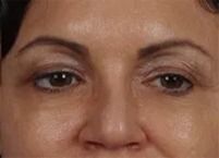 Close-up of a woman's eyes and forehead.