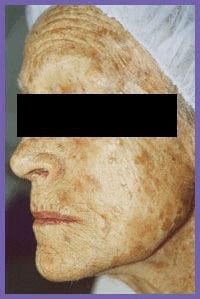 Aged human face with pronounced features.