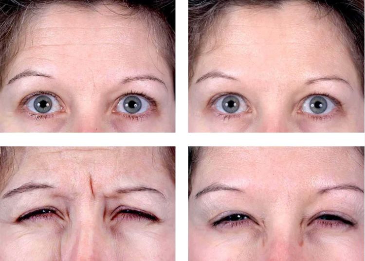 Different facial expressions showing eye variations.