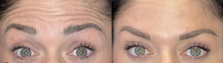 Before and after eye makeup transformation.