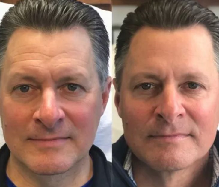 Before and after photo of man’s appearance.