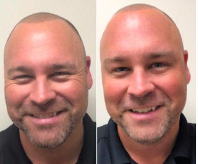 Smiling man, before and after transformation.