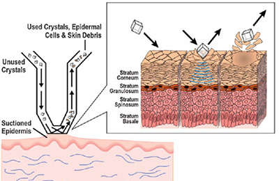 Microderm diagram