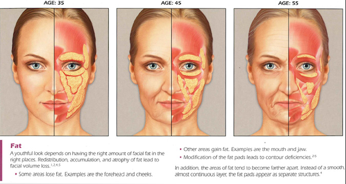 Collagen Pads and aging process diagram