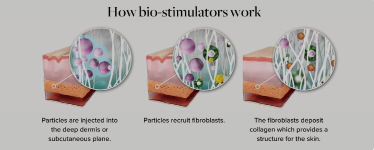 How Biostimulators Work Diagram