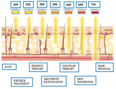 IPL Depth Diagram