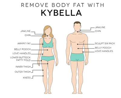 Kybella Fat Removal Santa Fe NM
