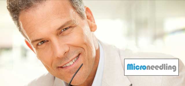 Microneedling for Men Santa Fe NM