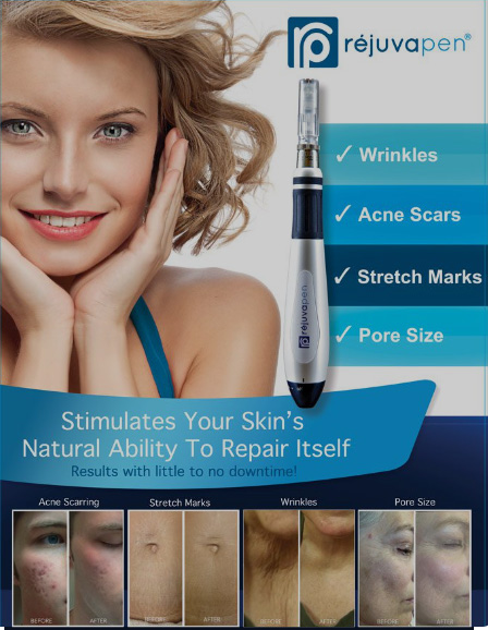 Rejuvapen Microneedling Santa Fe NM