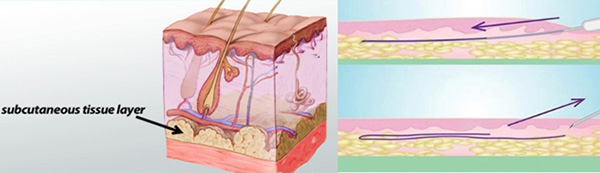 Skin Diagram