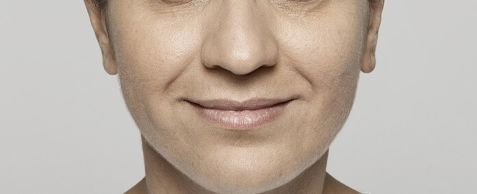 Restylane™ Lyft