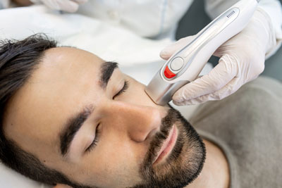 Microneedling Santa Fe