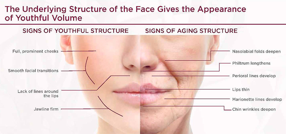 Underlying Structure of the Face for Sculptra