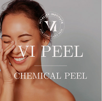 VI Peel Therapy in Santa Fe, NM