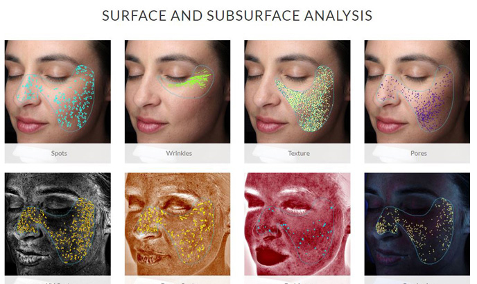 Visia Skin Surface and Subsurface Analysis Santa Fe NM