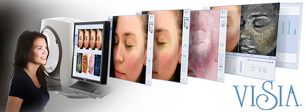 Visia Skin Analysis Santa Fe NM