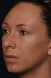 Vitalize Peel