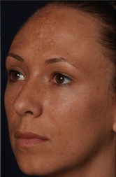 Vitalize Peel