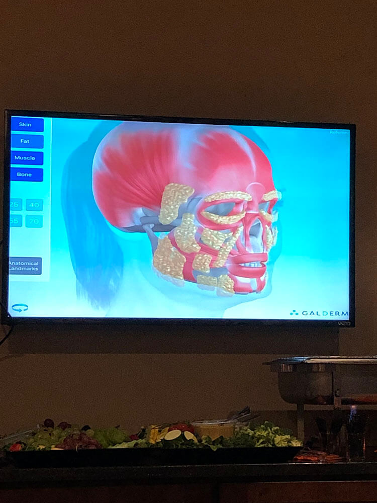 Sculptra Night 2019